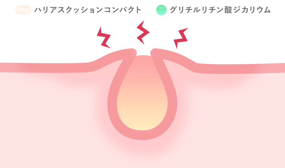 抗炎症の解説GIFアニメ